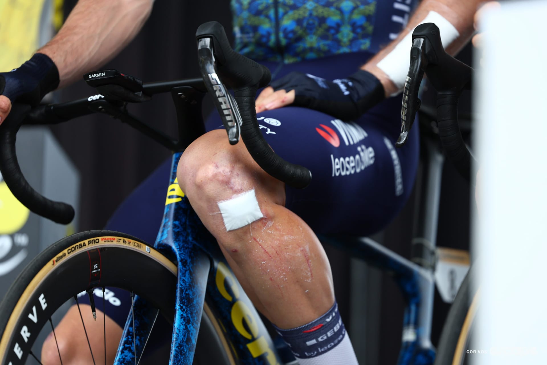 A day of heat and hurt at the Tour de France