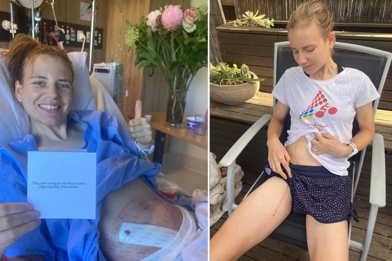 Sarah Gigante on her battle with external iliac artery endofibrosis