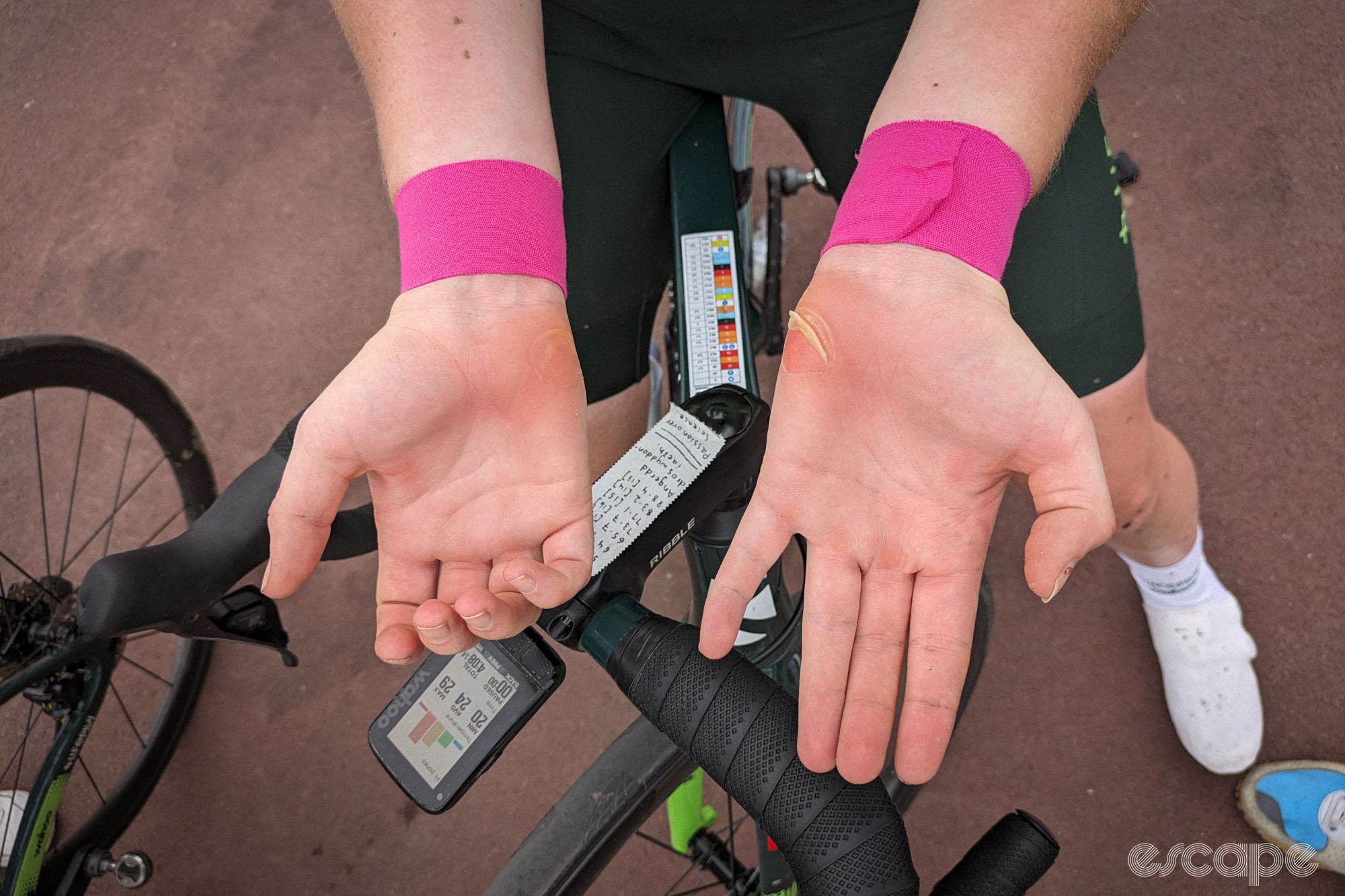 Elenud King's hands feature red marks on the palm pads and a large blister on the outside pad of each. Her wrists are wrapped in hot pink kinesiotape.