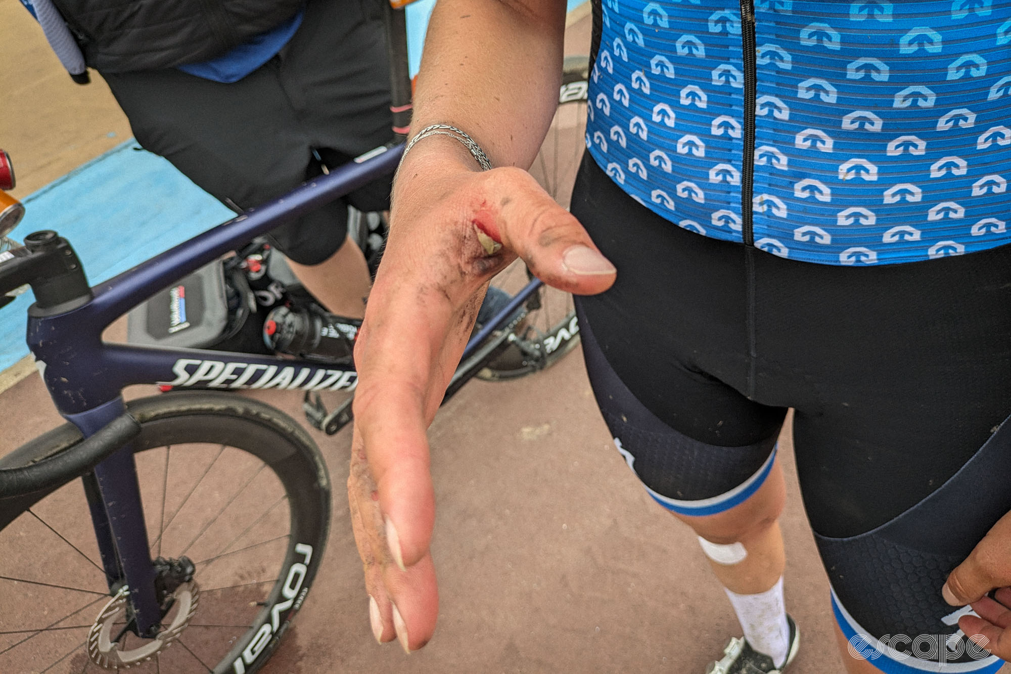 Femke Beuling's right hand has a nasty, cracked blister between thumb and forefinger. It's red and angry and there's a lot of dirt in it and we hope she cleans it out thoroughly.