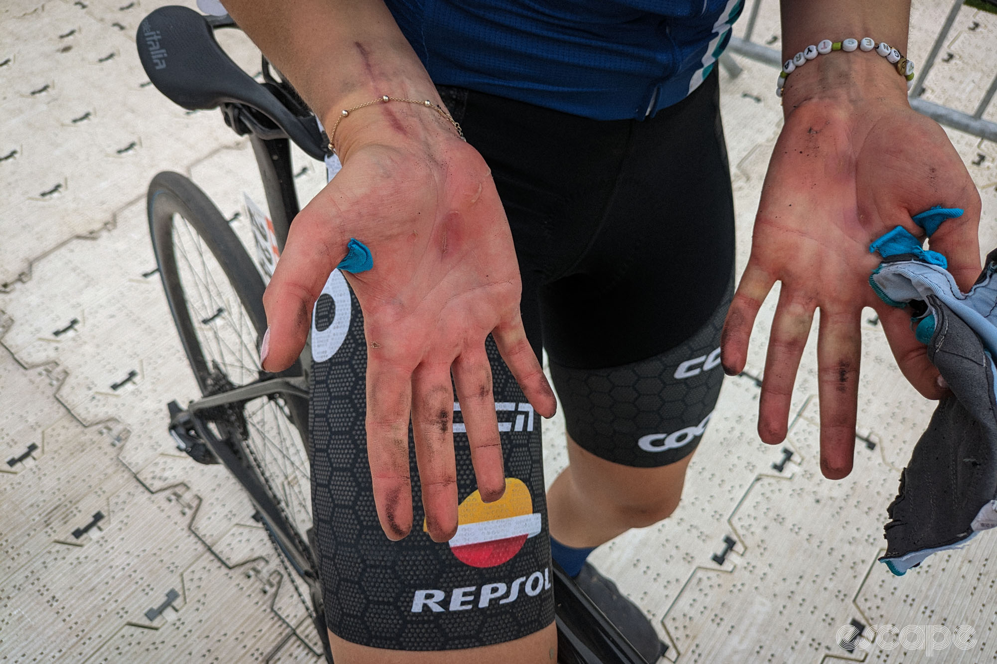 Stina Kavegi's hands are in particularly rough shape: dirty, tape between thumb and forefinger peeling, and several large blisters.