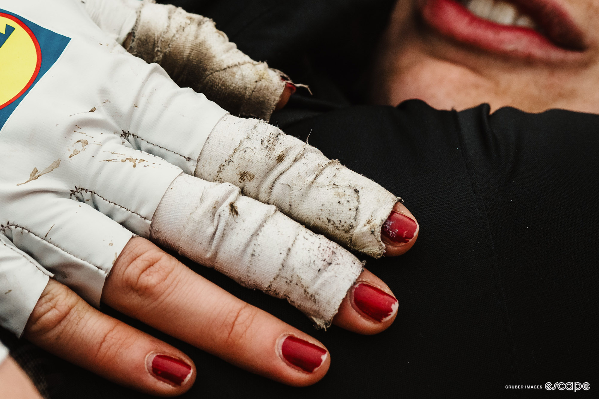 A Lidl-Trek rider's deep-red painted fingernails poke out past dirty wraps of tape and a mud-spattered glove.