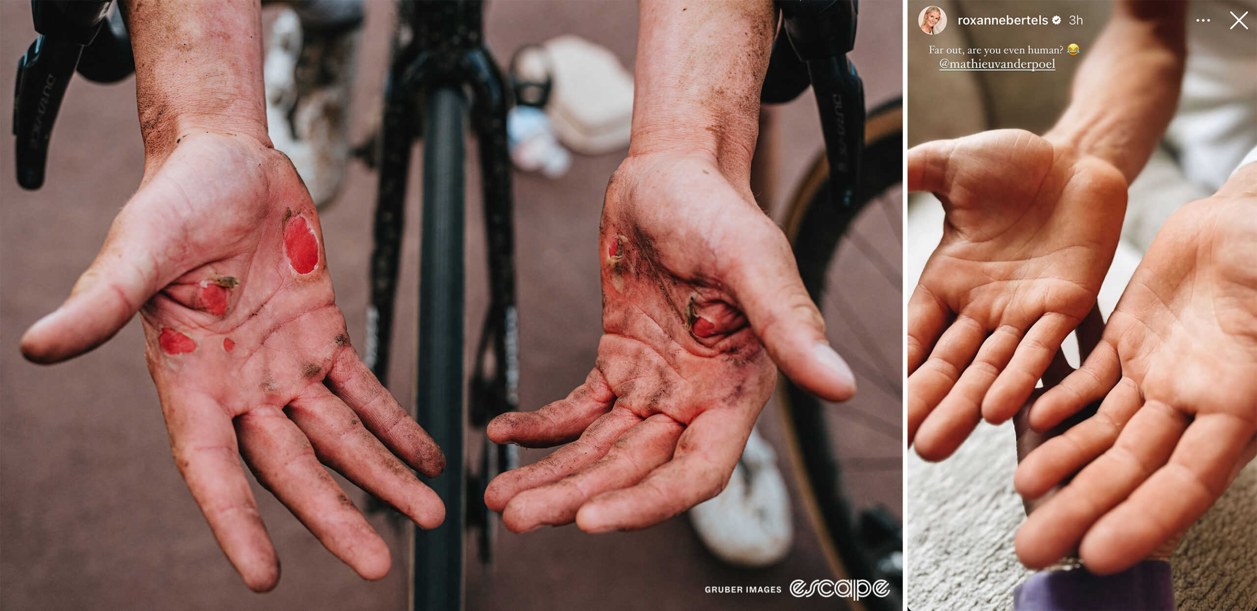 One rider's battered hands post Paris-Roubaix 2024 and then Mathieu van der Poel's unblemished hands after the same race.
